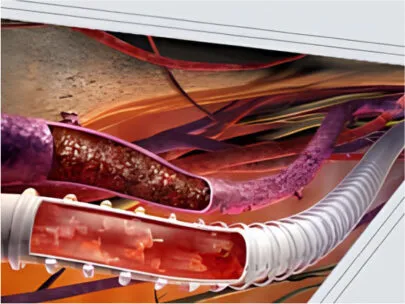PTFE na Área de Medicina e Odontologia