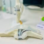 Artigo sobre prótese de PTFE - Megaflon